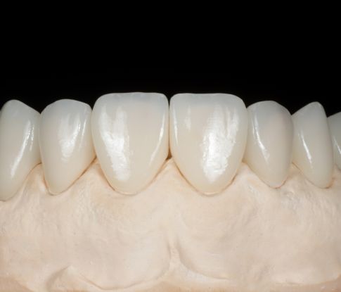 GT Odontologia - Clínica Odontológica em São José do Rio Preto - Laboratório de Prótese