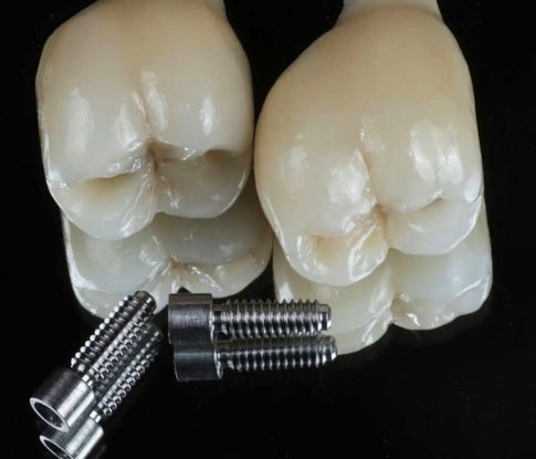 GT Odontologia - Clínica Odontológica em São José do Rio Preto - Implantodontia